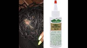 And while the oil itself likely can't make the hair grow, it's loved for its ability to create a healthier environment on the scalp that makes for way better hair growth. Wild Growth Hair Oil Does It Really Work Pics Included Youtube