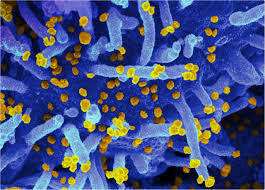 Mungkin dengan adanya informasi yang satu ini, bisa sedikit mengobati rasa penasaran kalian mengenai kumpulan foto viral not not terbaru 2021. Unvaccinated And Vaccinated Have Similar Viral Load In Communities High In Sars Cov 2 Delta