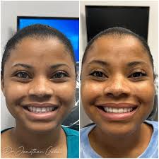 Dr. Jonathan Gabai (@drjonathangabai) · Instagram 照片和视频