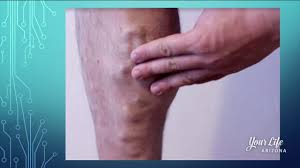 Patches of discolored skin have many possible causes, including birthmarks, pigmentation disorders, rashes, infections, and skin cancer. Skin Discoloration On Legs Ankles And Feet