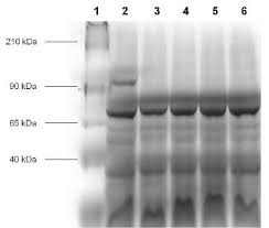 Click for other letters painting. Sds Page Of Recombinant Pichia Pastoris After 72 H Of Methanol Download Scientific Diagram