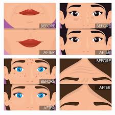 Image result for Comedolytic