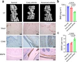 What is good for joints. Targeted Apoptosis Of Macrophages And Osteoclasts In Arthritic Joints Is Effective Against Advanced Inflammatory Arthritis Nature Communications