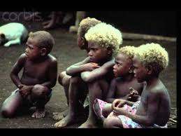 This is why many extremely pale people have freckles. Is True Blonde Headedness A Germanic Or Just A Northern European Heritage History Forum