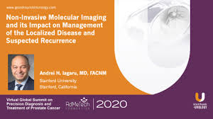 Managing complications of treatment a visual summary of the recommendations in nice guideline 131: Virtual Global Summit On Precision Diagnosis And Treatment Of Prostate Cancer Archives Grand Rounds In Urology