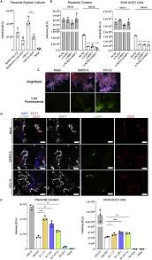 Inflammatory responses in the placenta upon SARS-CoV-2 infection late in  pregnancy: iScience
