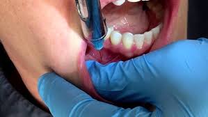 Why Dental Anesthetic Makes Your Heart Beat Faster | Oral Answers