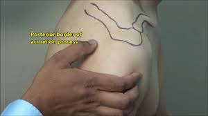 Image result for Subacromial Space Injection
