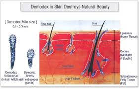 Image result for Demodex brevis