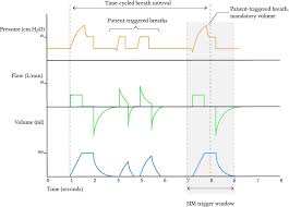 Mandatory And Spontaneous Modes Of Ventilation Deranged Physiology