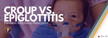 Image result for Epiglottitis