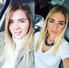 Hilal altınbilek'in estetiksiz hali hayranlarını şoka soktu! Toplanin Damla Ersubasi Nin Estetik Degil Photoshop Diyerek Savundugu Degisimini Inceliyoruz