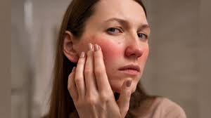 Por qué se hincha la cara: causas y posibles enfermedades