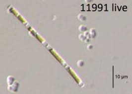 Image result for Leptonychia