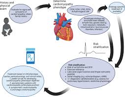 Image result for Cardiomyopathy