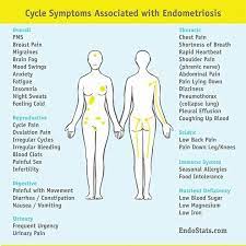 Therapies used to treat endometriosis include: Pin By Elena Lara On My Health Endometriosis Awareness Endometriosis Symptoms Endometriosis
