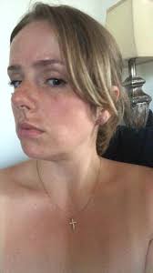 Hello, I’m just starting to look into the idea of having something done  with my neck, jowles. I’m 33 however have had over 150lb weight loss. I’m  wanting to know the cost, different types of ...