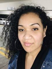 Before and After Duodenal Switch Photos