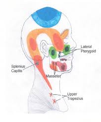 Shoulder Trigger Points Chart Www Bedowntowndaytona Com