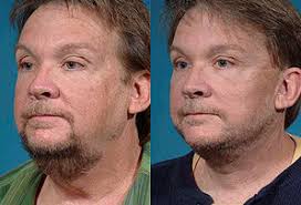 Jay Burns, MD, Board Certified Plastic Surgeon