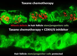 The good news is that new hair replacement technology recently brought to the. New Breakthrough In Cancer Hair Loss Treatment Discovered