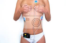 Zu beginn der untersuchung werden elektroden an den jeweiligen messpunkten (extremitäten und brust) angebracht. Junge Frau Tragt Einen Holter Herzmonitor Leinwandbilder Bilder Arrhythmie Ambulante Ekg Myloview De