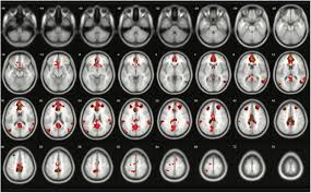 Jomstudy provides free spm revision notes to all students at no cost. Frontiers Using Spm 12 S Second Level Bayesian Inference Procedure For Fmri Analysis Practical Guidelines For End Users Frontiers In Neuroinformatics