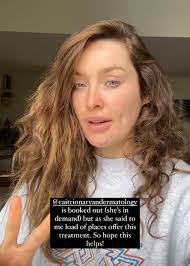 Roz Purcell Shares 'Reassuring' Alopecia Update After Second Round Of  Injections