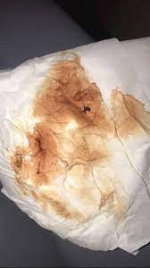 Maybe you would like to learn more about one of these? Implantation Bleeding Tmi Pic Hi There My Period Nct