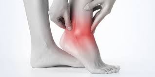 Menghilangkan bakteri dan kuman di kaki. Cek Fakta Hoaks Rendam Kaki Dengan Minyak Tanah Garam Es Bisa Sembuhkan Asam Urat Info Sehat Fkui