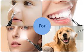 VITCOCO Ear Wax Removal Kit Ear Camera 1296P High-Definition Earwax Cleaner  Portable USB Charging Visible 6 LED Otoscope for Android, iPhone, Ipad :  Amazon.com.au: Health, Household & Personal Care