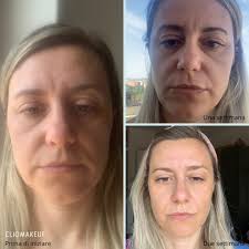 Il Face Taping funziona davvero? Quali sono i benefici? Il TeamClio l'ha  provato per voi