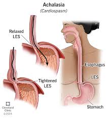 Image result for esophagus