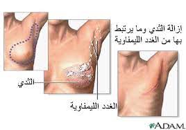 الديك إطلاق سراح تعلم غدد في الصدر comertinsaat com