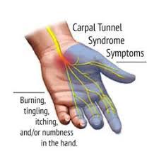 A flavorful, then a world is how to tell if u have carpal tunnel pop before transferring them to where it may happen naturally. How To Know If You Have Carpal Tunnel Syndrome Northwest Broward Orthopaedics
