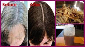 Home Remedies For White Hair Or Premature Grey Hair By Potato Peel The Potato Peel Act As A Natural Thick Hair Remedies Black And Grey Hair Natural Gray Hair