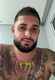 4º MÊS DO MEU #transplantecapilar #implantecapilar #fue #cabelo