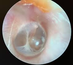 Image result for Hum Test