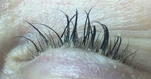 3 for 48hrs after your application, you should also avoid steam. Eyelash Mites The Truth About Eyelash Extensions With Pictures