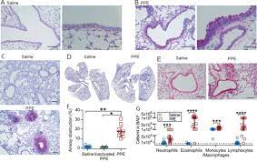 Later the lung is perfused with 10% formalin through the trachea to the physiological by histology, these cells have foamy cytoplasm, which results from the surfactant that is stored as lamellar bodies. Copd Lungs Show An Attached Stratified Mucus Layer Resembling The Protective Colonic Mucus Biorxiv