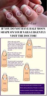 Pin By Ann Nagel On Health Fingernail Health Health