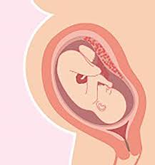 Image result for Labor Induction