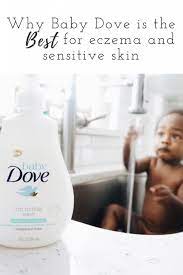 Help Soothe Sensitive Skin With Baby Dove Aseky The Boys Blog Baby Sensitive Skin Sensitive Skin Boys Blog