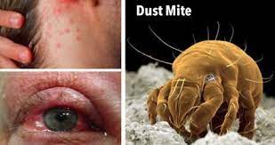We did not find results for: Mold And Dust Mites Are Great Friends Mold Help Org The World S Largest Toxic Mold Web Site