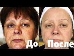 маски для лица от морщин после 30 в домашних условиях Minus Neskolko Let Za 8 Procedur Omolazhivayushaya Maska Dlya Zhenshin Posle 50 Let I Skrab Youtube 50 Let Starenie Leto