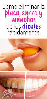 Como Eliminar El Sarro En Los Dientes Gingivitis Placa Dental Mal Aliento Gracias Este Aceite Comestible Dientes Health Tips Body Hacks Health