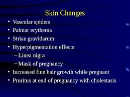 Spider telangiectasias develop in the majority of pregnant white women but are less often identified in women with darker skin. Physiological Changes In Pregnancy Grinkevich Tatiana