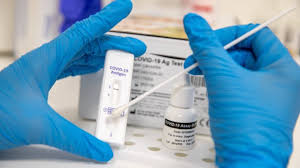 Was kostet der test und wer darf sich testen lassen? Corona Tests In Schweizer Apotheken Der Testraum Ist Im Moment Fur Mich Der Sicherste Ort In Der Apotheke
