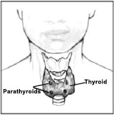 Image result for Hyperparathyroidism