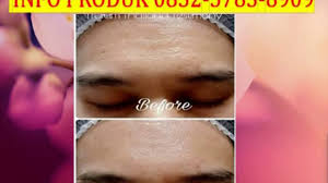 This tulum travel guide's for you. Harga Trulum Skincare Synergy Indonesia Review Lamongan Kosmetik Klinskin Beauty Soap Reynaldiarya